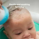 Cradle Cap